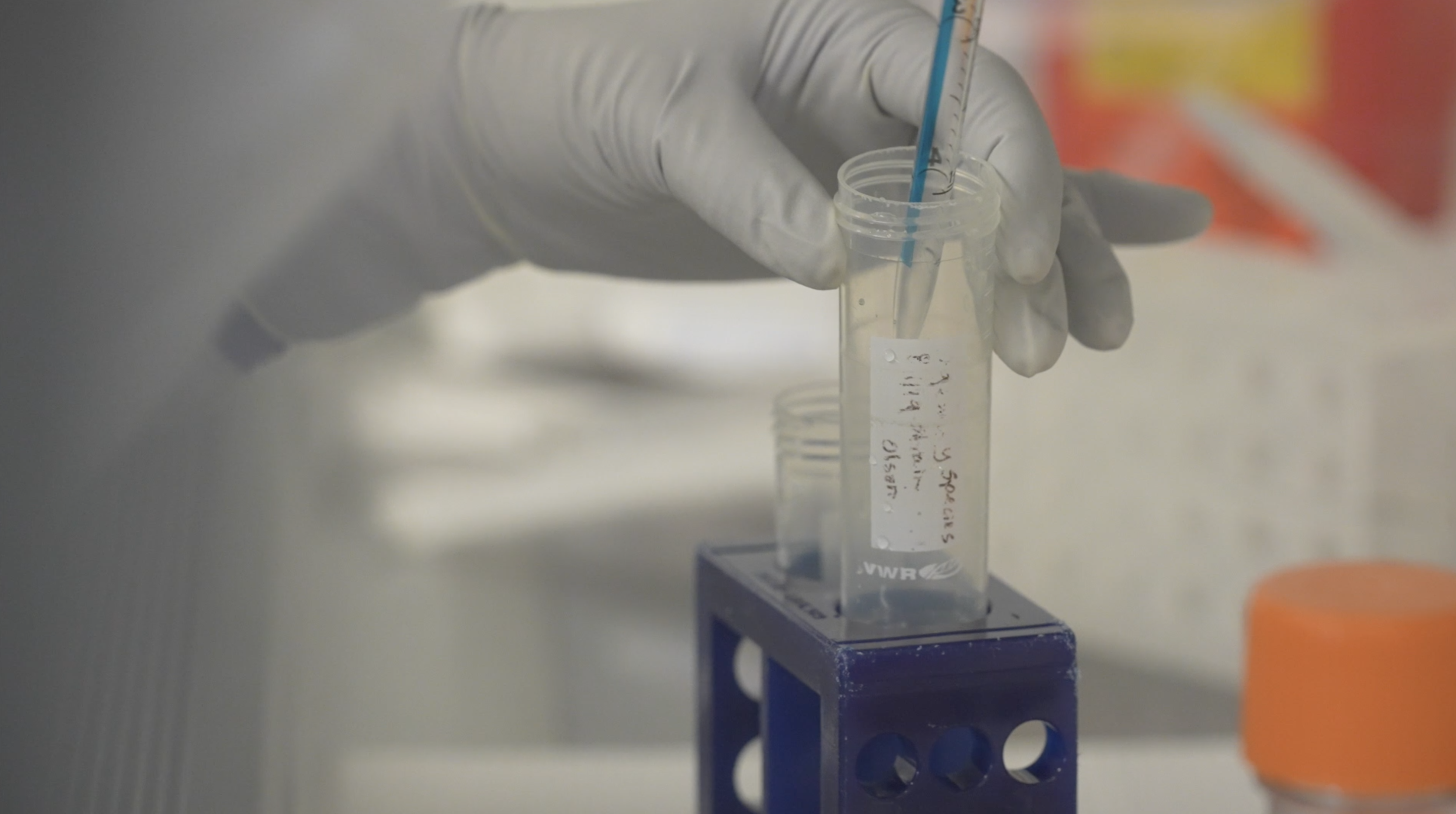 Researchers work to develop vaccine for future pandemics - Vimarsana News